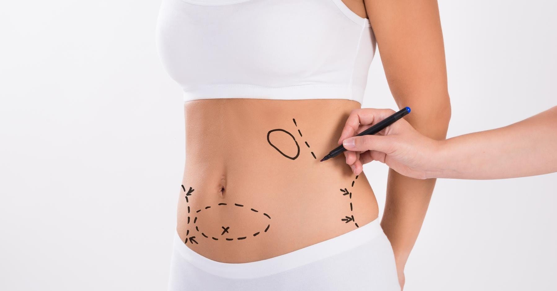 J-Plasma Treatment in Dubai, Liposuction in Dubai – Remove Stubborn Fat, Achieve Your Ideal Shape​