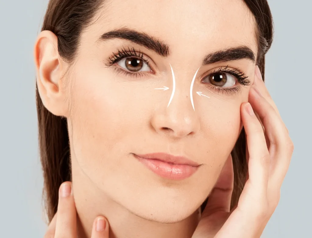 nose jobs in dubai