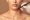 Chin Liposuction
