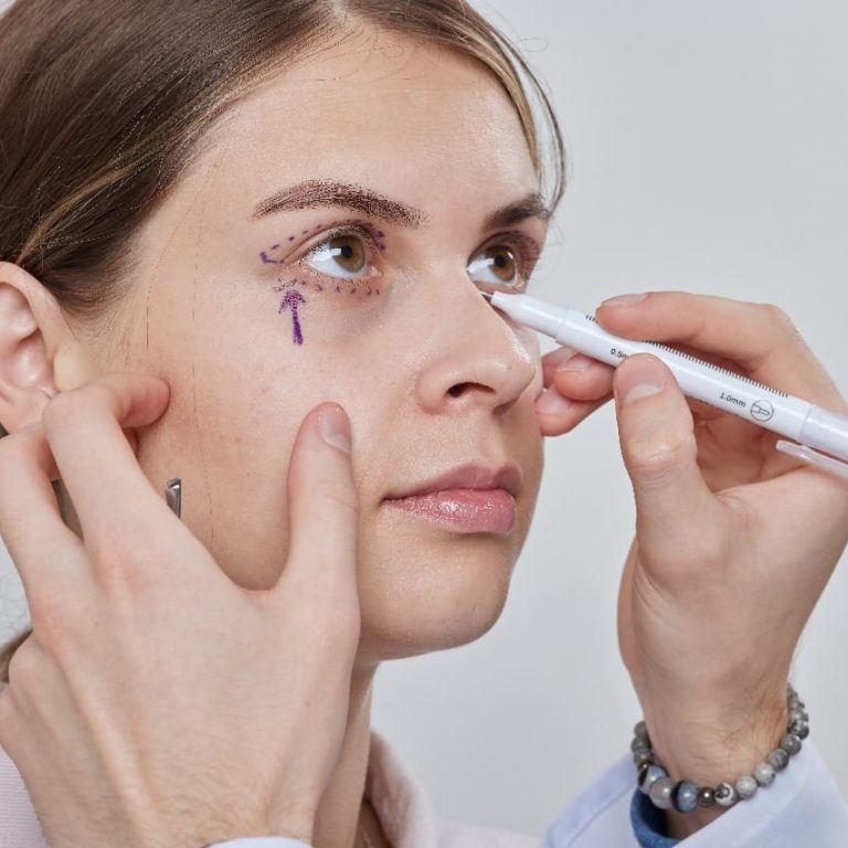 How Blepharoplasty Can Make You Look 10 Years Younger: The Ultimate Guide to Eyelid Surgery