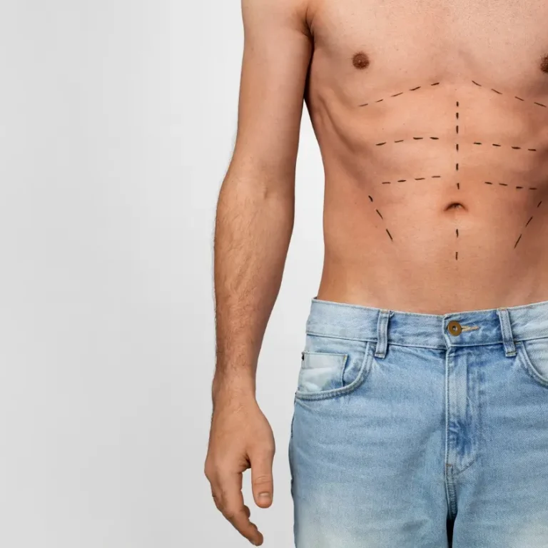 Gynecomastia Surgery in Dubai – Male Breast Reduction Dubai