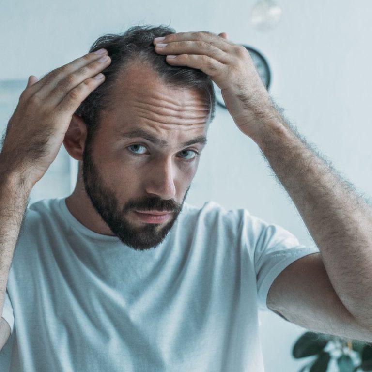 exosome treatment for hair loss