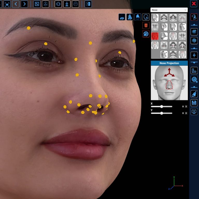 Kratos 3D | Transforming Craniofacial Surgery