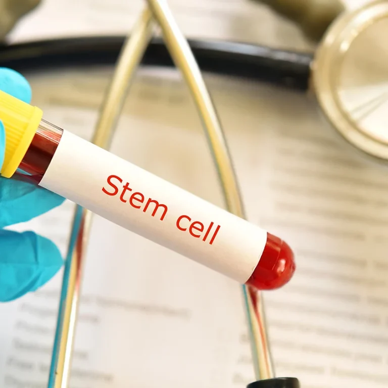 stem cell therapy Dubai